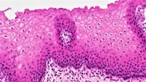 Stratified Squamous Epithelium