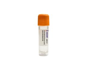 Immortalized Human Aortic Valve Interstitial Cell